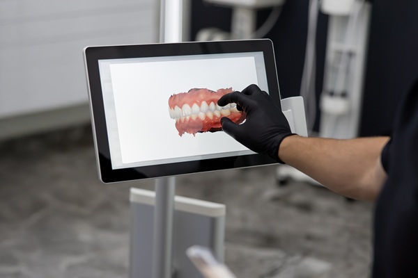 D Dental Scans Vs X Ray: Important Differences To Know