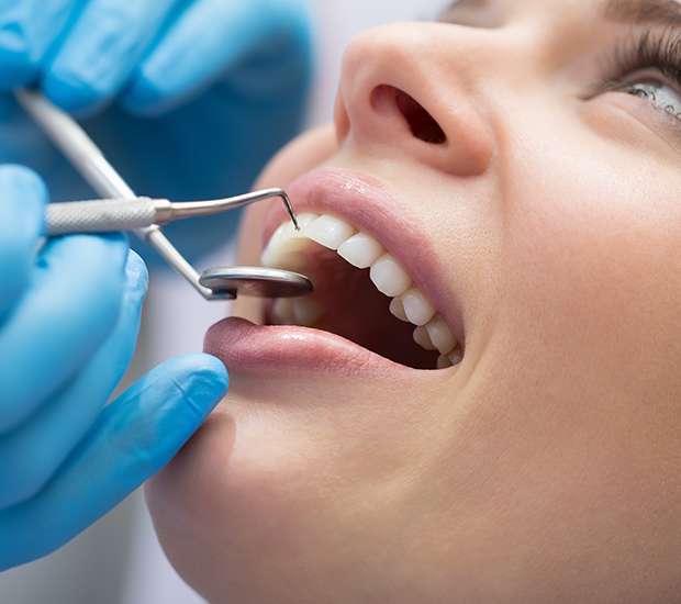 North Little Rock Dental Bonding