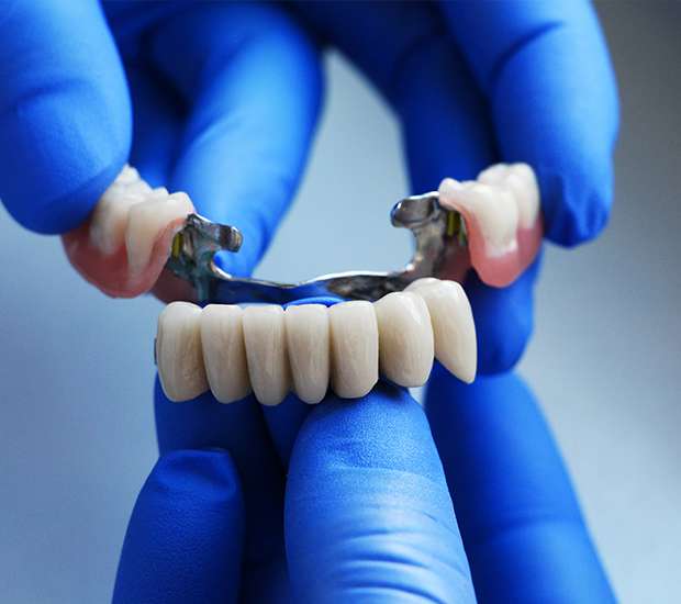 North Little Rock Dental Bridges