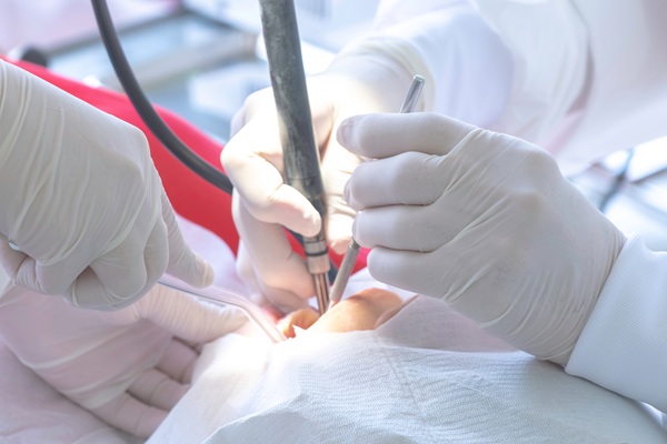 How A Dentist Can Use Composite Fillings To Improve Your Smile