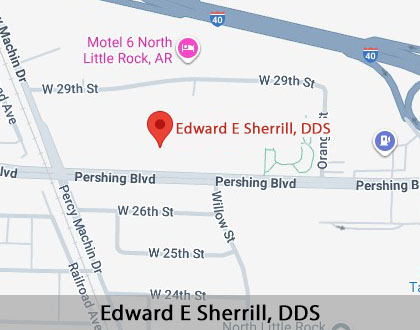 Map image for Root Canal Treatment in North Little Rock, AR