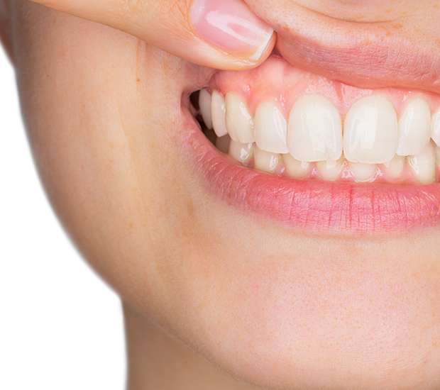 North Little Rock Gum Disease